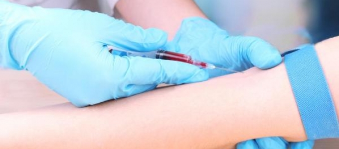 8 Reasons Why The Standard Western Blot Is A Poor Diagnostic Indicator of Lyme – and tips for making sense of your lab result 8 Reasons Why The Standard Western Blot Is A Poor Diagnostic Indicator of Lyme – and tips for making sense of your lab result